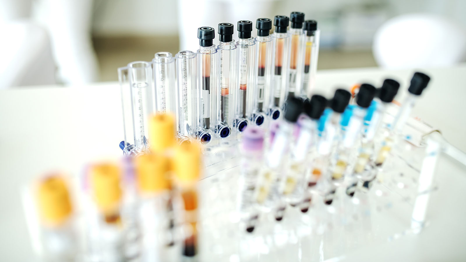 Blood sample tubes for thyroid, glucose and lipid testing before switching antidepressants because of weight gain